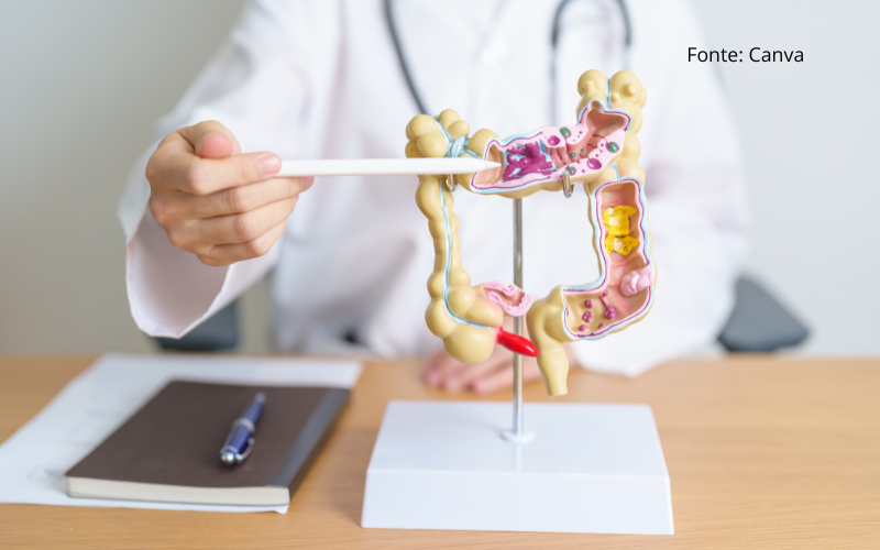 Síndrome do Intestino Irritável: como cuidar da saúde intestinal